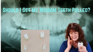 Should I get my wisdom teeth removed [upl. by Anrim]