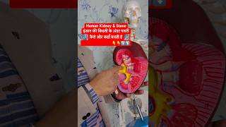 Human Kidney amp Renal Stone  इंसान की किडनी के अंदर पथरी कैसे और कहाँ बनती है viral shorts kidney [upl. by Leiram]