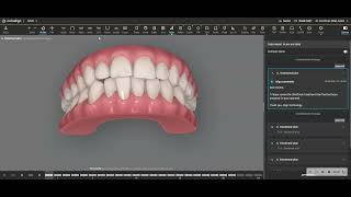 Interproximal Reduction with Invisalign is SAFE if planned properly [upl. by Ymar]