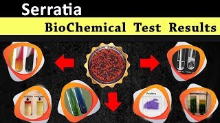 Serratia Biochemical test results [upl. by Iridis]