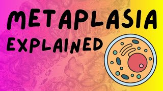 What is Metaplasia Types and Examples Pathology Help Pathology Lecture [upl. by Rehpotsihrc]