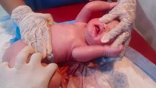 New born good siz baby with lots of clots vernix remove by baby oil baby is so beautifull thank u ❣️ [upl. by Doomham]