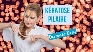 Kératose pilaire  boutons peau granuleuse poils incarnés comment se soigner  DermatoDrey [upl. by Osbourn]