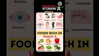 Vitamin A deficiency vitamin A rich foodsvitamin A symptoms vitamins [upl. by Hunsinger]