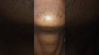 minoxidil 5 beard growth new pic  explore cover music [upl. by Gombach]