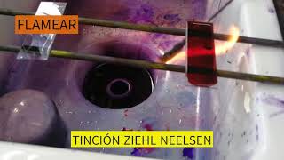 TINCION ZIEHL NEELSEN [upl. by Adelaida]