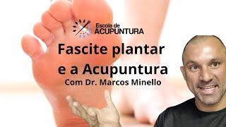 Acupuntura no Tratamento da Fascite Plantar [upl. by Letsyrc]