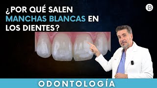 ¿Por qué salen MANCHAS BLANCAS en los dientes🦷 [upl. by Arinaid161]