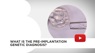 Preimplantation genetic diagnosis PDG [upl. by Pulsifer405]