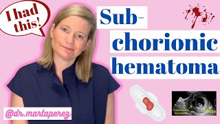 OBGYN Explains Subchorionic Hematoma  My Story First Trimester Bleeding [upl. by Oiuqise]