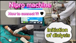 Initiation of hemodialysis via AV fistula nipro machine hemodialysishospital ckdpatient [upl. by Allyson]