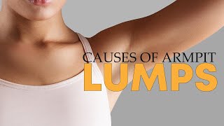 How To Treat Your Symptoms And Understand The Causes Of Armpit Lump  Tiggio [upl. by Kirby]