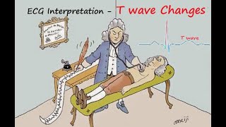 ECG Interpretation T wave Changes Part VII [upl. by Joacima]