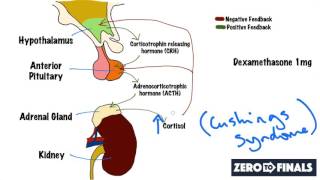 Understanding The Dexamethasone Suppression Test [upl. by Orabelle]