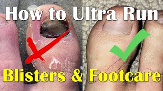 Blisters Prevention and Footcare for runners  How to Run an Ultra Marathon [upl. by Nahtanod]