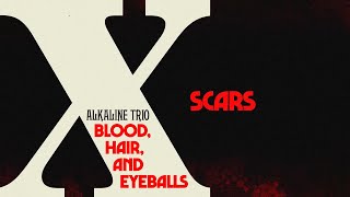 Alkaline Trio  Scars Official Visualizer [upl. by Dincolo36]