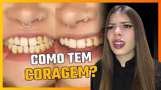 ELA PINTOU OS DENTES COM ESMALTE  VEJA O QUE ACONTECE  Dentista de Ouro reage [upl. by Leann]