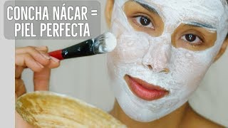 Elimina Cicatrices De Acne Estrias y Aclarar La Piel Con Concha Nacar En 1 Semana [upl. by Aynor257]