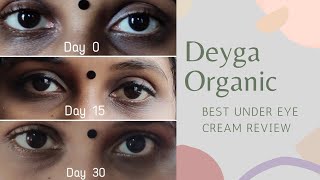 Ankhon Ke Halke Kam Karne Ka Tarika  Saeed Ghani Eye Cream For Dark Circles  Under Eye Treatment [upl. by Woodley379]