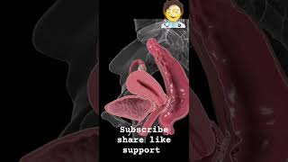 endometriosis shortsfeed youtubeshorts shorts [upl. by Landes709]