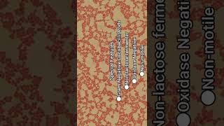 Gramnegative coccobacilli to Gramnegative rods of Acinetobacter in Gram Staining [upl. by Olmsted]