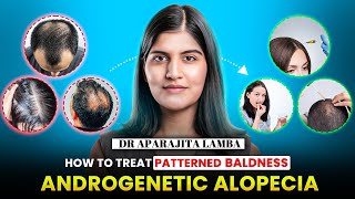 Androgenic Alopecia What Is It amp What To Do About It Solution For Hair Baldness [upl. by Winnah490]