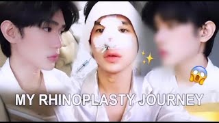 MY RHINOPLASTY JOURNEY [upl. by Marozik]