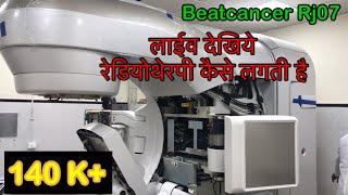 रेडीयोथैरेपी कैसे लगती है How to give radiotherapy [upl. by Anor]