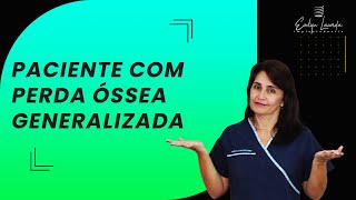 Paciente com Perda Óssea Generalizada [upl. by Harcourt]