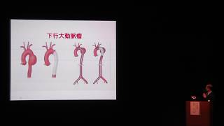 市民公開健康講座「知っておきたい大動脈瘤のお話」（高の原中央病院 かんさいハートセンター 心臓血管外科 部長：金田 幸三氏） [upl. by Haldan]