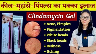 Clindamycin and Niacinamide gel uses benefits dose side effects  Clinsol gel  Clindamycin gel [upl. by Dadelos815]