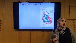 Fallot Tetralogy Part 1  Soha Romeih [upl. by Atiragram]