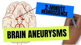 2Minute Neuroscience Brain Aneurysms [upl. by Ainoet1]