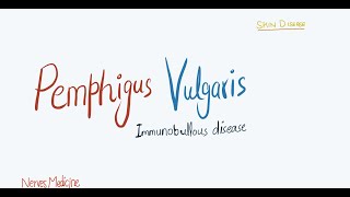 Pemphigus Vulgaris  clinical features pathophysiology and histology  immunobullous skin disease [upl. by Minna]