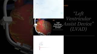 Left Ventricular Assist Device LVAD [upl. by Notsa]