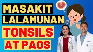 Masakit Lalamunan Tonsils at Paos Ano ang Lunas  By Doc Gim Dimaguila and Doc Liza Ong1542 [upl. by Atterehs959]