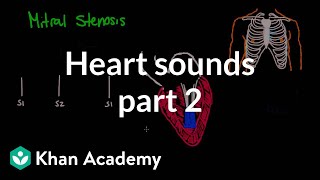 Systolic murmurs diastolic murmurs and extra heart sounds  Part 2  NCLEXRN  Khan Academy [upl. by Lustick]