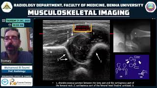 Imaging of pediatric hip joint [upl. by Ominorej]