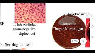 Meningococcal meningitis [upl. by Whitman148]