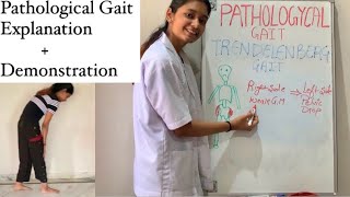 Pathological Gait  Exercise Therapy  Types Explained  physiotherapy [upl. by Leach]