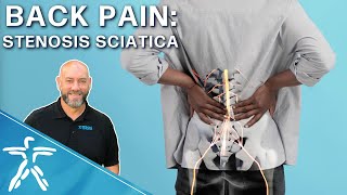 What can you do about Stenosis Sciatica Back Pain [upl. by Ahsieym]