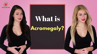 What is Acromegaly  Causes Pictures Signs and Symptoms of Acromegaly [upl. by Boggers]