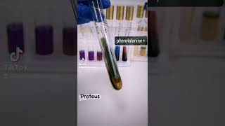 Proteus showing positive phenylalanine deamination test Microbiology medicalmicrobiology [upl. by Ytsirk493]