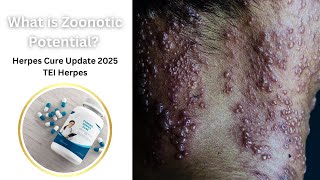 What is Zoonotic Potential Herpes Cure Update 2025  TEI Herpes [upl. by Aizahs]