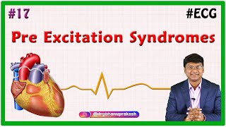 17 Pre Excitation Syndromes  LownGanongLevine syndrome amp WolffParkinsonWhite WPW pattern [upl. by Dearr22]