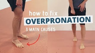 Pronated Feet and How to Fix 3 Different Causes of OVERPRONATION [upl. by Rambow561]