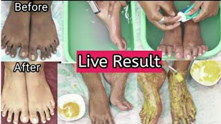 Feet Whitening Pedicure At Home  Remove Suntan amp Whiten Your Skinkanmani beauty tips [upl. by Chladek20]