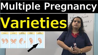 Multiple Pregnancy Varieties amp Incidences  Nursing Lecture [upl. by Safier]