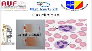 MORPHOLOGIE EN HEMATOLOGIE EPISODE 10 [upl. by Doughty515]