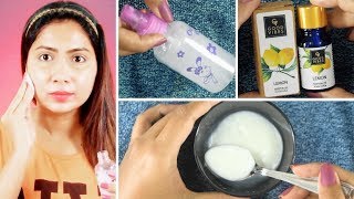 Top 5 Uses of Lemon Essential Oil  Skin Brightening Pigmentation Acne  How To Use Essential Oils [upl. by Anhej]